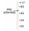 p65 antibody, AP01648PU-N, Origene, Western Blot image 
