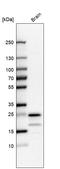 Transmembrane Protein 35A antibody, HPA048583, Atlas Antibodies, Western Blot image 