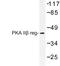 Protein Kinase CAMP-Dependent Type II Regulatory Subunit Beta antibody, LS-C177434, Lifespan Biosciences, Western Blot image 