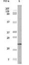 Eukaryotic Translation Initiation Factor 4E Binding Protein 1 antibody, 32-103, ProSci, Western Blot image 