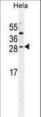 Insulin Like Growth Factor 2 antibody, LS-C165143, Lifespan Biosciences, Western Blot image 