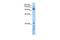 RecQ Like Helicase 5 antibody, GTX47524, GeneTex, Western Blot image 