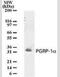 Peptidoglycan Recognition Protein 3 antibody, NBP2-33249, Novus Biologicals, Western Blot image 