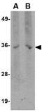HCLS1 Associated Protein X-1 antibody, GTX84983, GeneTex, Western Blot image 