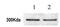 ATR Serine/Threonine Kinase antibody, ab2905, Abcam, Western Blot image 