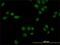 Nuclear Receptor Subfamily 1 Group D Member 1 antibody, H00009572-M02, Novus Biologicals, Immunofluorescence image 