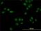 Nuclear Receptor Subfamily 1 Group D Member 1 antibody, H00009572-M02, Novus Biologicals, Immunofluorescence image 