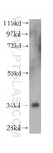 Neuroguidin antibody, 16524-1-AP, Proteintech Group, Western Blot image 