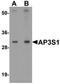 ORMDL Sphingolipid Biosynthesis Regulator 1 antibody, orb75614, Biorbyt, Western Blot image 