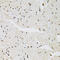 Fos-related antigen 1 antibody, 19-622, ProSci, Immunohistochemistry paraffin image 