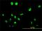 Testis Specific Serine Kinase 1B antibody, H00083942-M02, Novus Biologicals, Immunocytochemistry image 