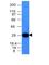 Immunoglobulin Kappa Variable 1D-16 antibody, NBP2-45081, Novus Biologicals, Western Blot image 