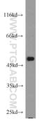 C-Terminal Src Kinase antibody, 17720-1-AP, Proteintech Group, Western Blot image 