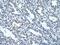 Nuclear Receptor Subfamily 2 Group F Member 2 antibody, PA5-46850, Invitrogen Antibodies, Immunohistochemistry paraffin image 