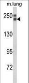 Collagen Type XVIII Alpha 1 Chain antibody, LS-C166920, Lifespan Biosciences, Western Blot image 