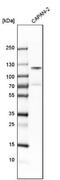 Cutaneous T-cell lymphoma-associated antigen 5 antibody, NBP1-85391, Novus Biologicals, Western Blot image 