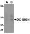 CD209 Molecule antibody, M01025-1, Boster Biological Technology, Western Blot image 