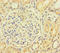 Actin Like 9 antibody, LS-C677057, Lifespan Biosciences, Immunohistochemistry paraffin image 