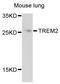 Triggering Receptor Expressed On Myeloid Cells 2 antibody, abx126734, Abbexa, Western Blot image 