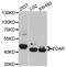 DL antibody, A4461, ABclonal Technology, Western Blot image 