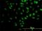 Tripartite Motif Containing 33 antibody, H00051592-M01, Novus Biologicals, Immunocytochemistry image 