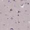 Dihydrouridine Synthase 2 antibody, NBP1-91853, Novus Biologicals, Immunohistochemistry paraffin image 