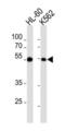 Myocyte Enhancer Factor 2C antibody, TA302220, Origene, Western Blot image 