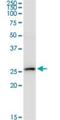 Interferon Alpha 2 antibody, H00003440-M36, Novus Biologicals, Western Blot image 