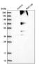 Ring Finger Protein 139 antibody, NBP1-83212, Novus Biologicals, Western Blot image 