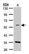 Carnitine O-Acetyltransferase antibody, PA5-27829, Invitrogen Antibodies, Western Blot image 