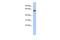 Kelch Like Family Member 7 antibody, PA5-44515, Invitrogen Antibodies, Western Blot image 