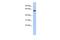 Kelch Like Family Member 7 antibody, PA5-44515, Invitrogen Antibodies, Western Blot image 