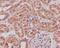 Sirtuin 1 antibody, M00018, Boster Biological Technology, Immunohistochemistry paraffin image 