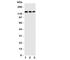 Collagen Type I Alpha 1 Chain antibody, R31257, NSJ Bioreagents, Western Blot image 