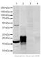 Teratocarcinoma-Derived Growth Factor 1 antibody, ab19917, Abcam, Western Blot image 