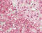 SS-A antibody, LS-B12053, Lifespan Biosciences, Immunohistochemistry paraffin image 