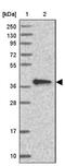 Cytokine Induced Apoptosis Inhibitor 1 antibody, NBP1-89097, Novus Biologicals, Western Blot image 