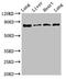 Lysyl Oxidase Like 2 antibody, LS-C678504, Lifespan Biosciences, Western Blot image 