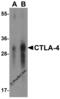 Cytotoxic T-Lymphocyte Associated Protein 4 antibody, RF16013, ProSci, Western Blot image 