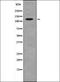 ACK1 antibody, orb336006, Biorbyt, Western Blot image 