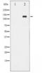 ABL Proto-Oncogene 1, Non-Receptor Tyrosine Kinase antibody, LS-C416422, Lifespan Biosciences, Western Blot image 