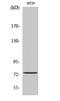 Acyl-CoA Synthetase Short Chain Family Member 1 antibody, A07972-2, Boster Biological Technology, Western Blot image 