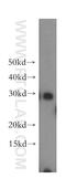 Mitochondrial Translational Initiation Factor 3 antibody, 14219-1-AP, Proteintech Group, Western Blot image 