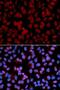 TNF Alpha Induced Protein 3 antibody, LS-C748675, Lifespan Biosciences, Immunofluorescence image 