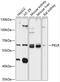 Pyruvate Kinase L/R antibody, 14-367, ProSci, Western Blot image 