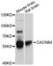 Calcium Voltage-Gated Channel Auxiliary Subunit Beta 4 antibody, STJ111648, St John