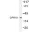 Prolactin Releasing Hormone Receptor antibody, LS-C177303, Lifespan Biosciences, Western Blot image 