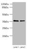 Phospholipid Phosphatase 2 antibody, orb356163, Biorbyt, Western Blot image 