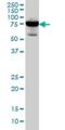 Radixin antibody, H00005962-M06, Novus Biologicals, Western Blot image 