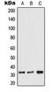 Transformer 2 Alpha Homolog antibody, orb224094, Biorbyt, Western Blot image 